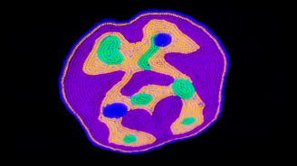 Neurotransmitting, Theo Cuthand